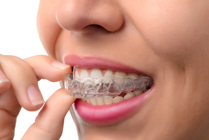 The benefit of orthodontics