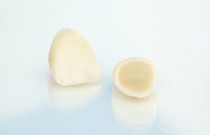 porcelain-crowns-300x194 dental crowns